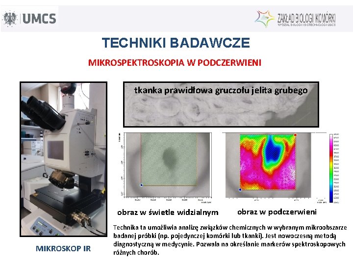 TECHNIKI BADAWCZE MIKROSPEKTROSKOPIA W PODCZERWIENI tkanka prawidłowa gruczołu jelita grubego obraz w świetle widzialnym