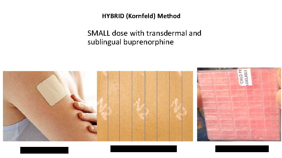 HYBRID (Kornfeld) Method SMALL dose with transdermal and sublingual buprenorphine Micro gram Bup patch