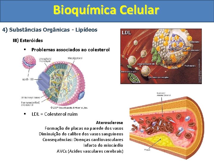 Bioquímica Celular 4) Substâncias Orgânicas - Lipídeos III) Esteróides § Problemas associados ao colesterol