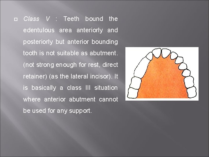  Class V : Teeth bound the edentulous area anteriorly and posteriorly but anterior