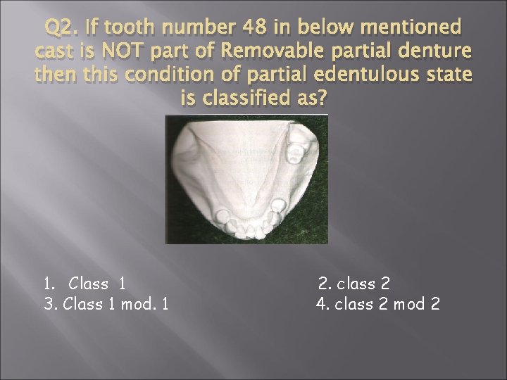 Q 2. If tooth number 48 in below mentioned cast is NOT part of