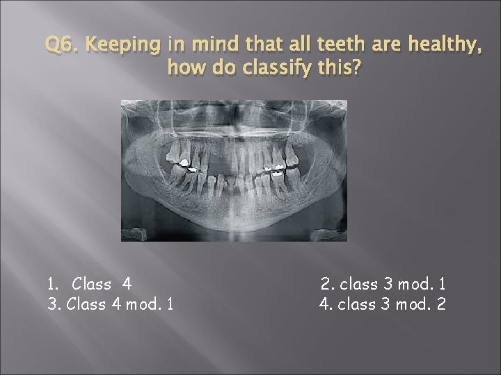 Q 6. Keeping in mind that all teeth are healthy, how do classify this?