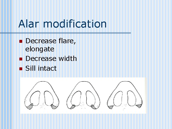 Alar modification n Decrease flare, elongate Decrease width Sill intact 