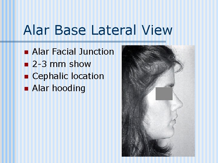Alar Base Lateral View n n Alar Facial Junction 2 -3 mm show Cephalic