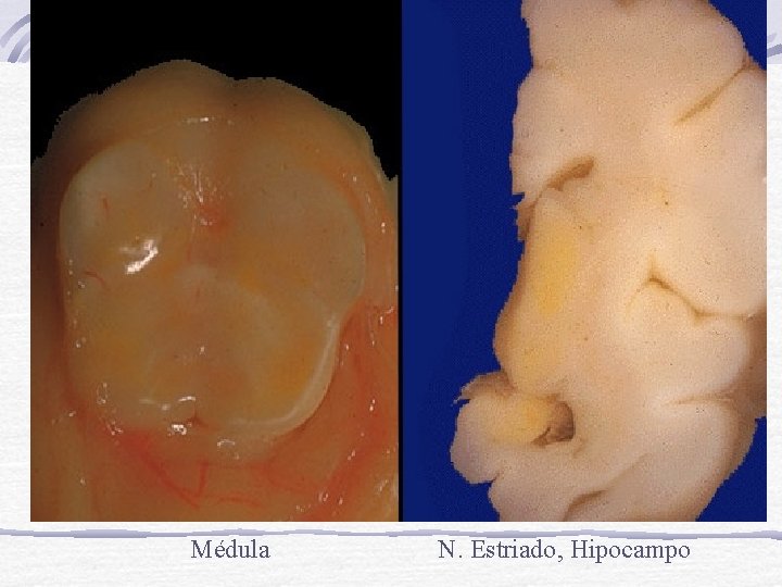 Médula N. Estriado, Hipocampo 