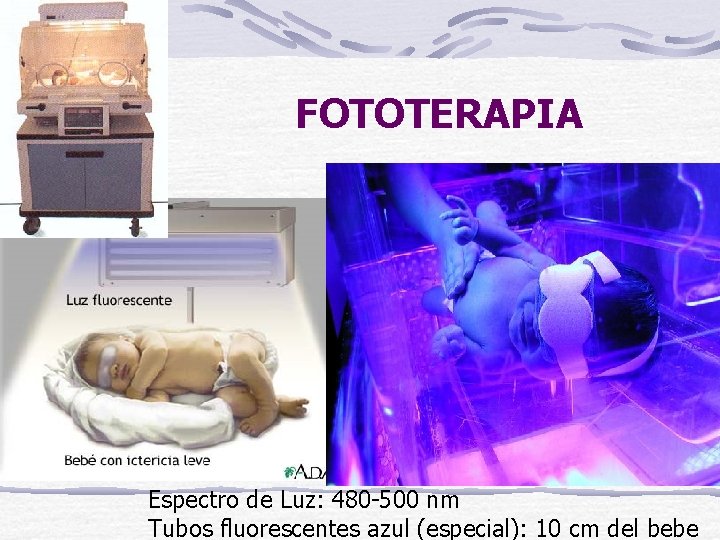 FOTOTERAPIA Espectro de Luz: 480 -500 nm Tubos fluorescentes azul (especial): 10 cm del