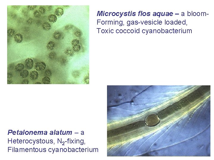 Microcystis flos aquae – a bloom. Forming, gas-vesicle loaded, Toxic coccoid cyanobacterium Petalonema alatum