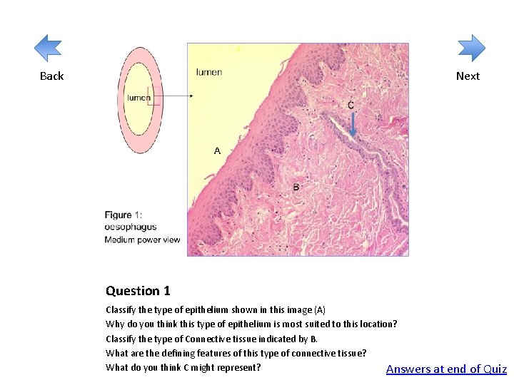Back Next Question 1 Classify the type of epithelium shown in this image (A)