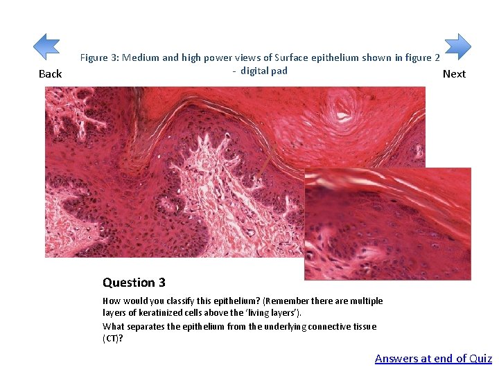 Back Figure 3: Medium and high power views of Surface epithelium shown in figure