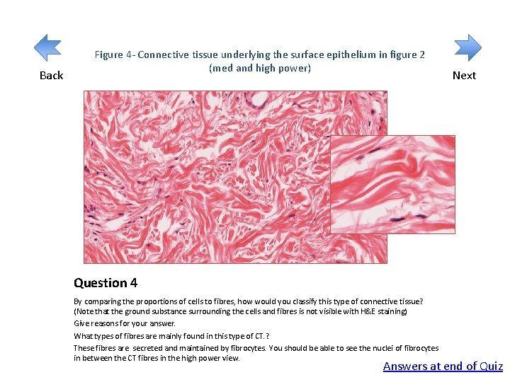 Back Figure 4 - Connective tissue underlying the surface epithelium in figure 2 (med