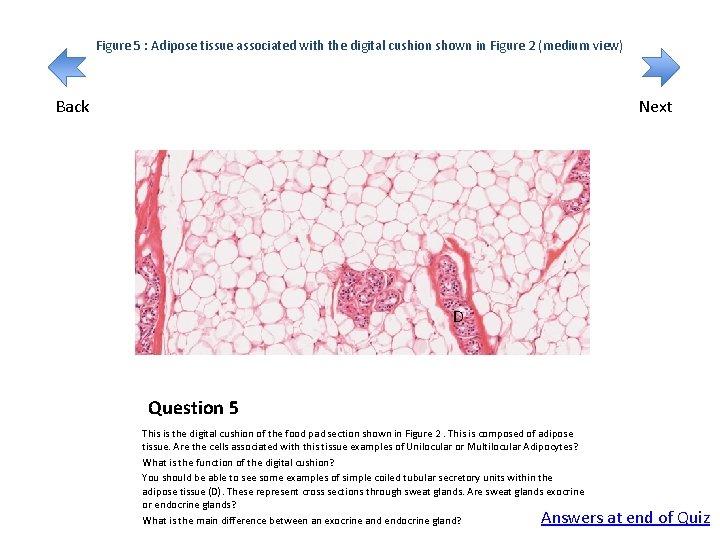 Figure 5 : Adipose tissue associated with the digital cushion shown in Figure 2