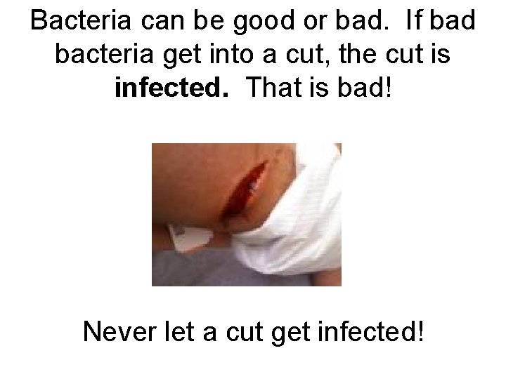 Bacteria can be good or bad. If bad bacteria get into a cut, the