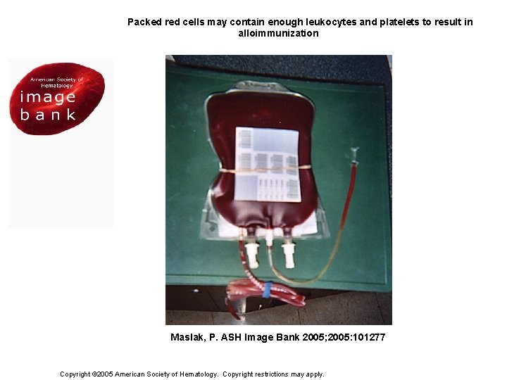 Figure 1. Packed red cells may contain enough leukocytes and platelets to result in