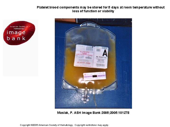 Figure 1. Platelet blood components may be stored for 5 days at room temperature