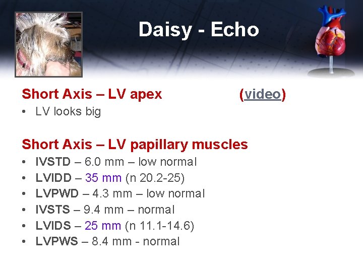 Daisy - Echo Short Axis – LV apex (video) • LV looks big Short