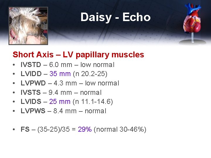 Daisy - Echo Short Axis – LV papillary muscles • • • IVSTD –