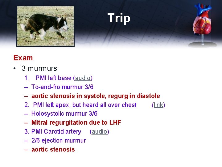 Trip Exam • 3 murmurs: 1. PMI left base (audio) – To-and-fro murmur 3/6