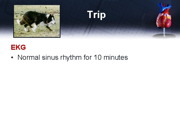 Trip EKG • Normal sinus rhythm for 10 minutes 
