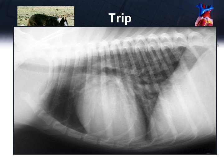 Trip EKG • Normal sinus rhythm for 10 minutes 