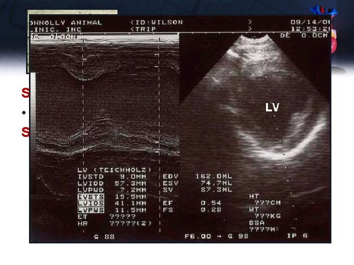 Trip - Echo Short Axis – LV Apex • No abnormalities noted Short Axis