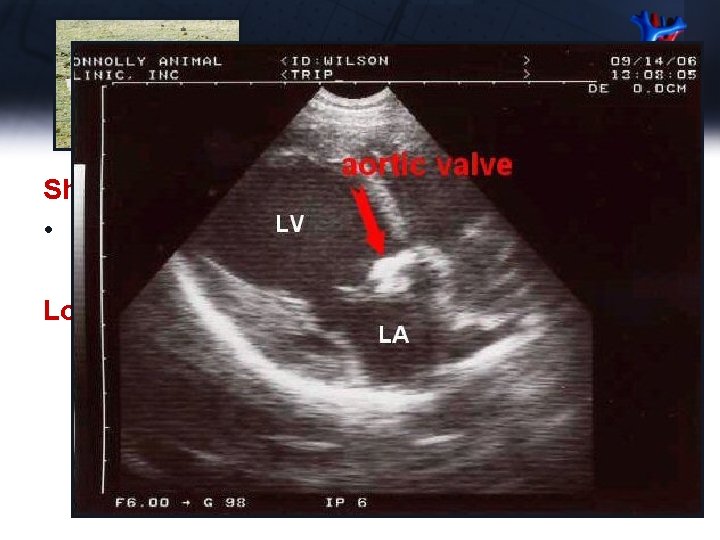 Trip - Echo Short Axis – PA • No abnormalities noted Long Axis –