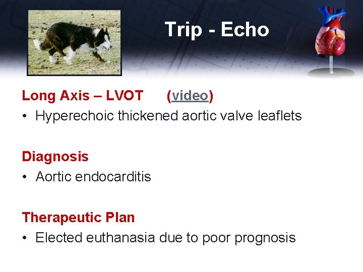 Trip - Echo Long Axis – LVOT (video) • Hyperechoic thickened aortic valve leaflets