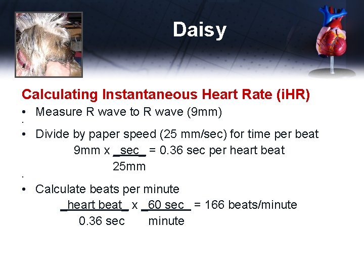 Daisy Calculating Instantaneous Heart Rate (i. HR) • Measure R wave to R wave