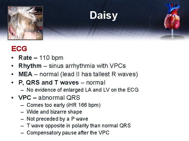 Daisy ECG • • Rate – 110 bpm Rhythm – sinus arrhythmia with VPCs