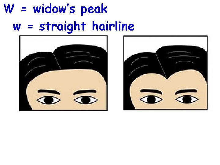 W = widow’s peak w = straight hairline 