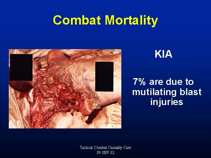 Combat Mortality KIA 7% are due to mutilating blast injuries Tactical Combat Casualty Care