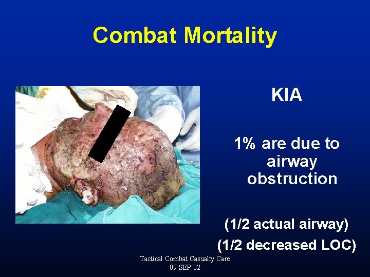 Combat Mortality KIA 1% are due to airway obstruction (1/2 actual airway) (1/2 decreased