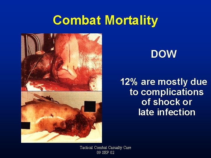 Combat Mortality DOW 12% are mostly due to complications of shock or late infection