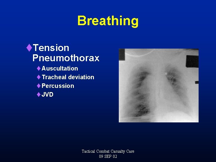 Breathing t. Tension Pneumothorax t Auscultation t Tracheal deviation t Percussion t JVD Tactical