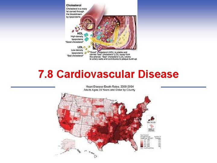 7. 8 Cardiovascular Disease 