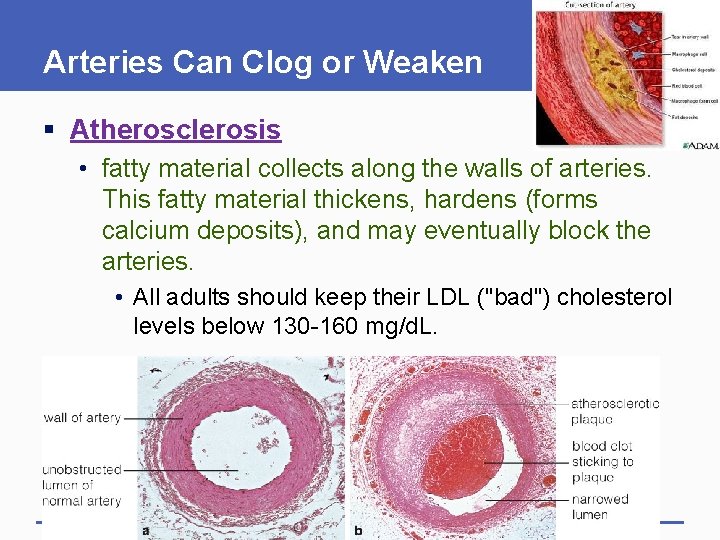 Arteries Can Clog or Weaken § Atherosclerosis • fatty material collects along the walls