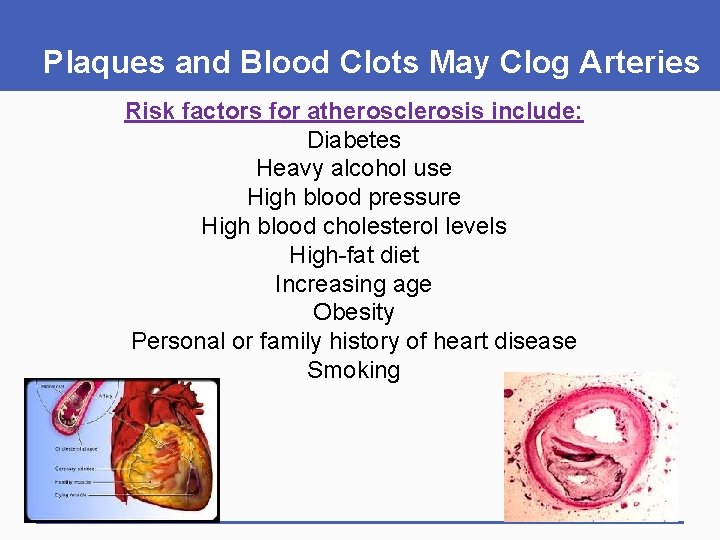 Plaques and Blood Clots May Clog Arteries Risk factors for atherosclerosis include: Diabetes Heavy