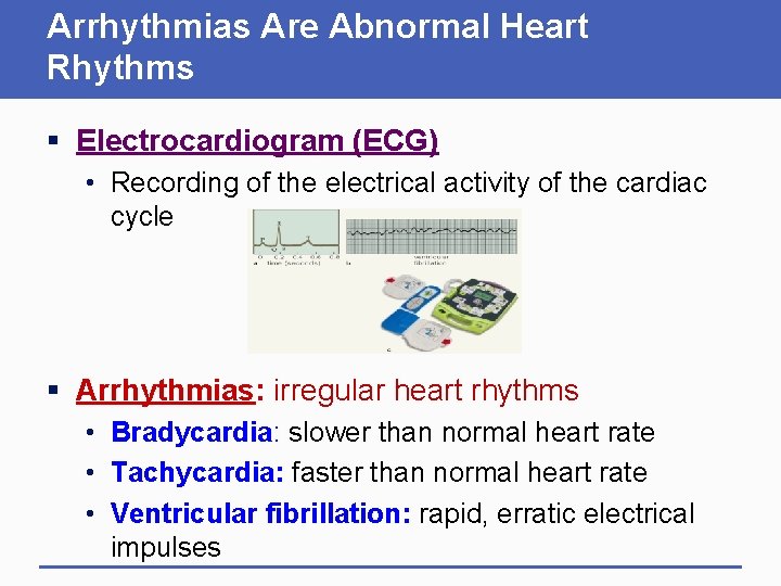 Arrhythmias Are Abnormal Heart Rhythms § Electrocardiogram (ECG) • Recording of the electrical activity