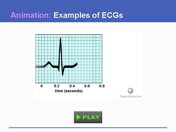 Animation: Examples of ECGs 