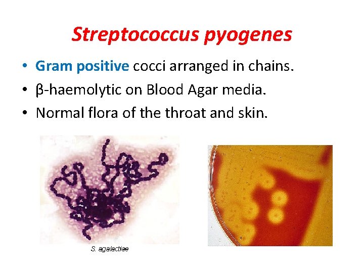 Streptococcus pyogenes • Gram positive cocci arranged in chains. • β-haemolytic on Blood Agar