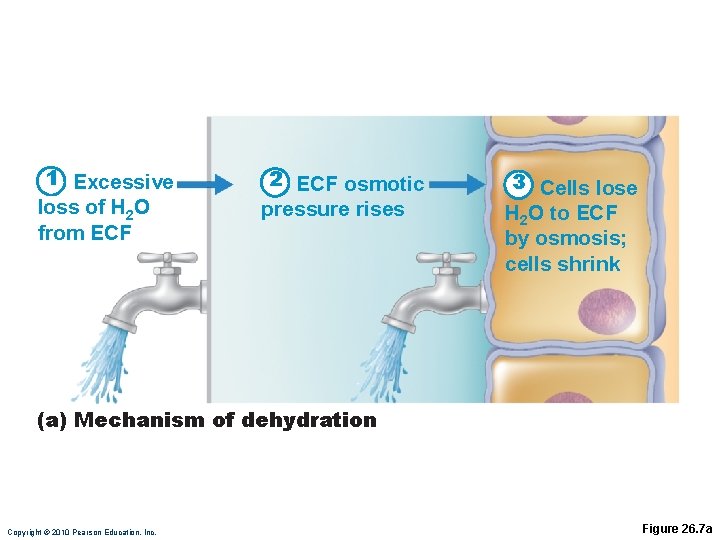 1 Excessive loss of H 2 O from ECF 2 ECF osmotic pressure rises