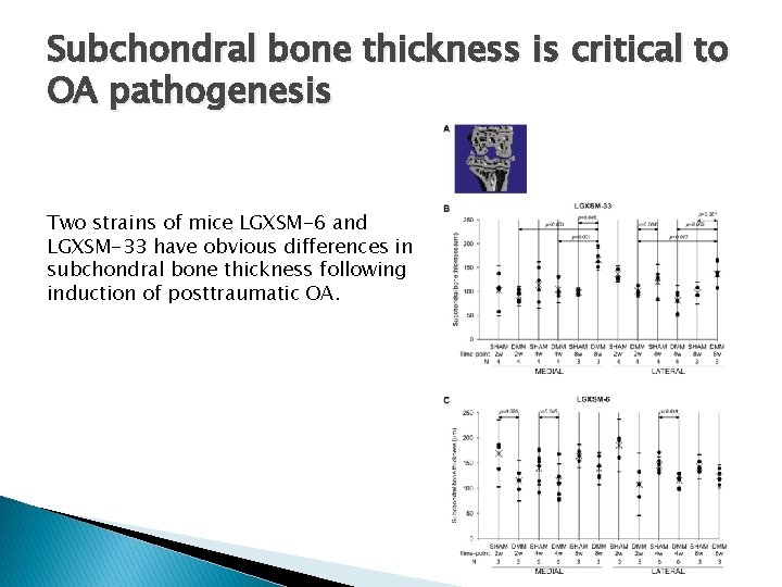 Subchondral bone thickness is critical to OA pathogenesis Two strains of mice LGXSM-6 and