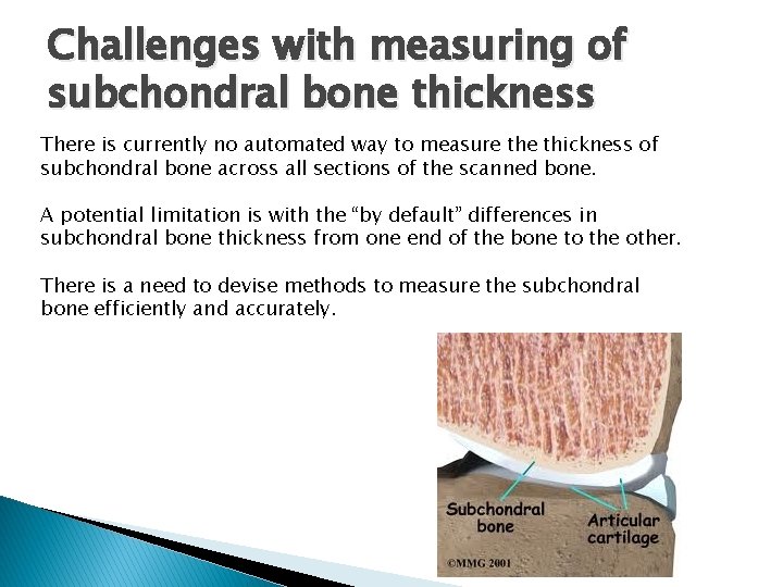 Challenges with measuring of subchondral bone thickness There is currently no automated way to