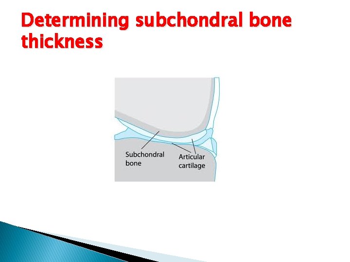 Determining subchondral bone thickness 