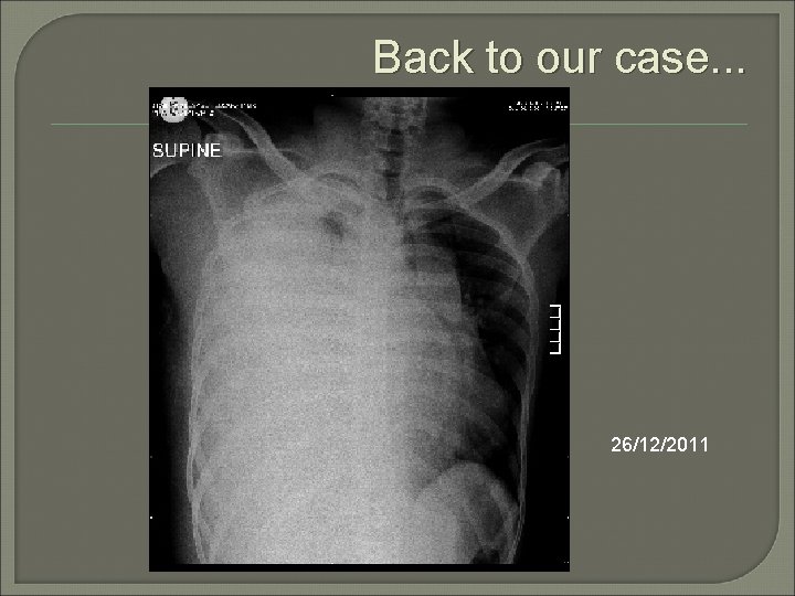 Back to our case. . . 26/12/2011 