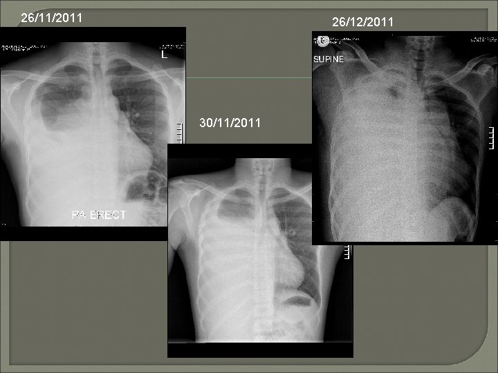 26/11/2011 26/12/2011 30/11/2011 