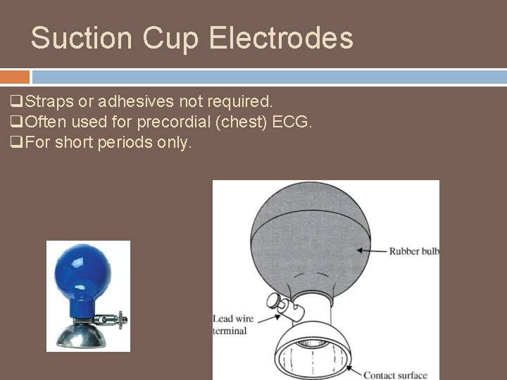 Suction Cup Electrodes q. Straps or adhesives not required. q. Often used for precordial