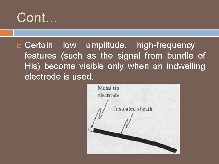 Cont… Certain low amplitude, high-frequency features (such as the signal from bundle of His)