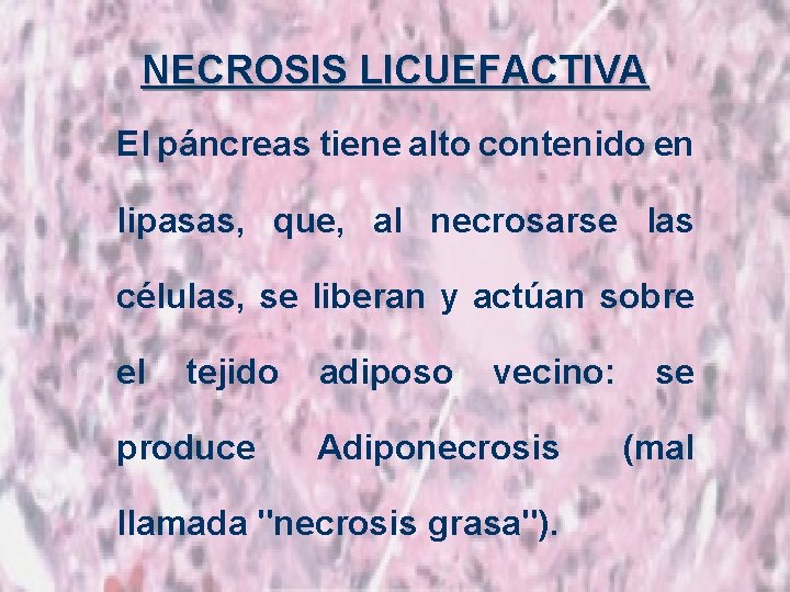 NECROSIS LICUEFACTIVA El páncreas tiene alto contenido en lipasas, que, al necrosarse las células,