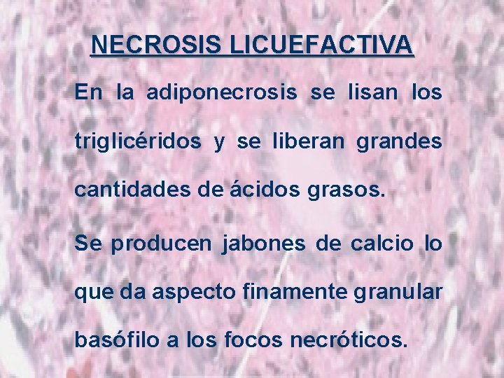 NECROSIS LICUEFACTIVA En la adiponecrosis se lisan los triglicéridos y se liberan grandes cantidades