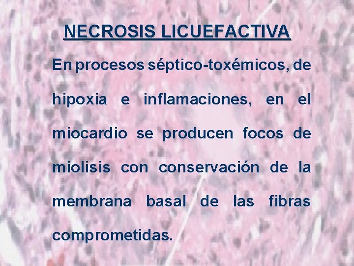 NECROSIS LICUEFACTIVA En procesos séptico-toxémicos, de hipoxia e inflamaciones, en el miocardio se producen